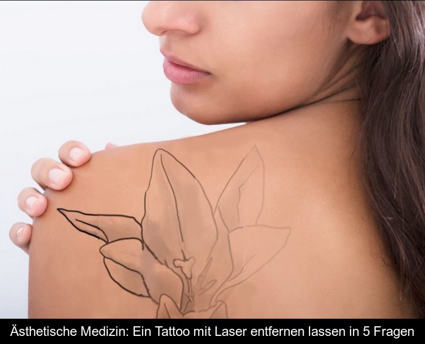 Ästhetische Medizin: Ein Tattoo Mit Laser Entfernen Lassen In 5 Fragen