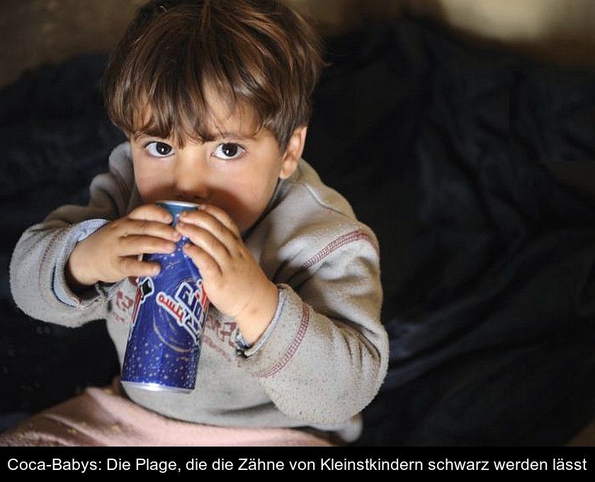 Coca-babys: Die Plage, Die Die Zähne Von Kleinstkindern Schwarz Werden Lässt