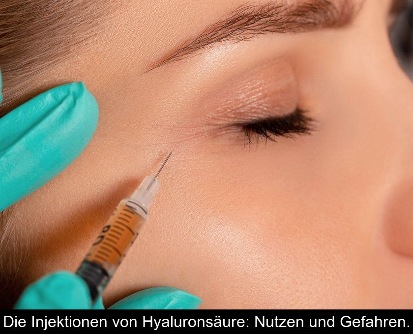 Die Injektionen Von Hyaluronsäure: Nutzen Und Gefahren.
